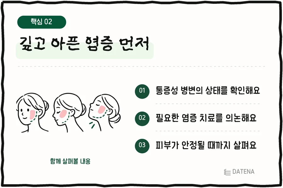 깊고 아픈 염증 먼저: 통증성 병변의 상태를 확인해요; 필요한 염증 치료를 의논해요; 피부가 안정될 때까지 살펴요 — 다태나의원 설명 카드